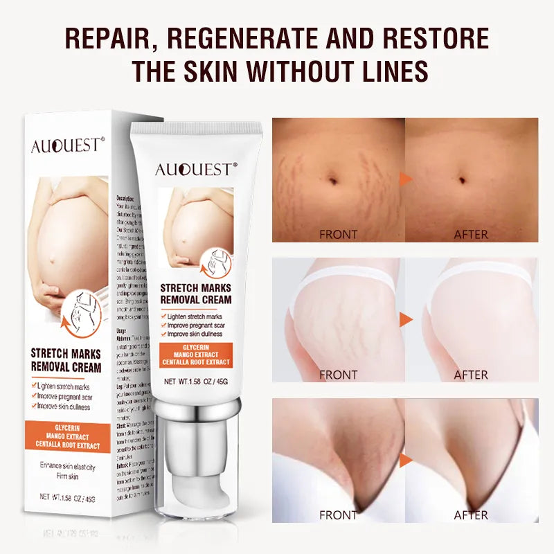 Pregnancy Stretch Mark Cream – Hydrating, Firming Body Moisturizer GoochiGoochi