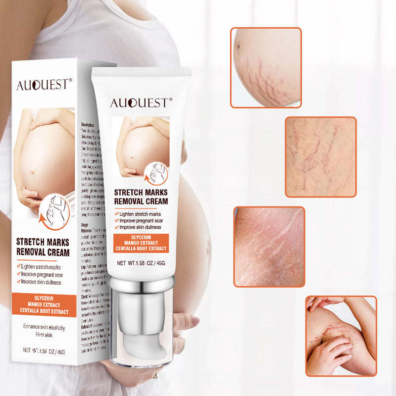 Remove Pregnancy Scars Acne Cream Stretch Mark Treatment Maternity Repair Anti-Aging Anti-Winkle Firming Body Cream GoochiGoochi