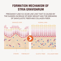 Pregnancy Stretch Mark Cream – Hydrating, Firming Body Moisturizer GoochiGoochi