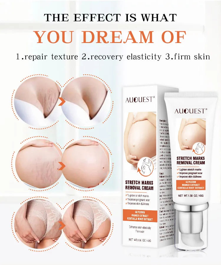 <p><img src="https://cdn.shopify.com/s/files/1/0952/4982/6169/files/feac75af-aef3-4667-91cc-cf1faafa3f0e.webp?v=1765035322" alt="Applying stretch mark cream on abdomen" style="max-width:100%;margin-bottom:10px;"></p>
