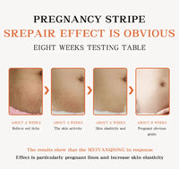 <p><img src="https://cdn.shopify.com/s/files/1/0952/4982/6169/files/5645fe54-2f1d-4025-924a-c64afb56fe2f.webp?v=1765035321" alt="Front view of stretch mark cream for pregnant women" style="max-width:100%;margin-bottom:10px;"></p>
